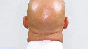 Cara Tahallul "Halku" (Botak licin) Bagi Jamaah Umroh Pria